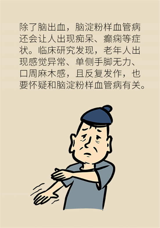身體出現(xiàn)這些癥狀要小心，可能是腦出血發(fā)出的信號