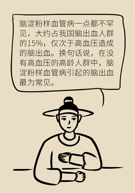 身體出現(xiàn)這些癥狀要小心，可能是腦出血發(fā)出的信號
