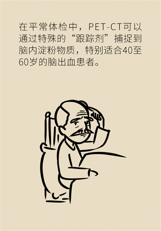 身體出現(xiàn)這些癥狀要小心，可能是腦出血發(fā)出的信號