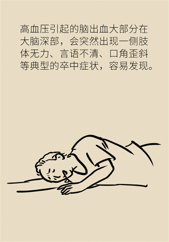 身體出現(xiàn)這些癥狀要小心，可能是腦出血發(fā)出的信號