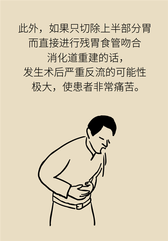 胃癌手術(shù)一定要全切胃？專家：視情況而定