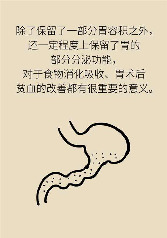胃癌手術(shù)一定要全切胃？專家：視情況而定
