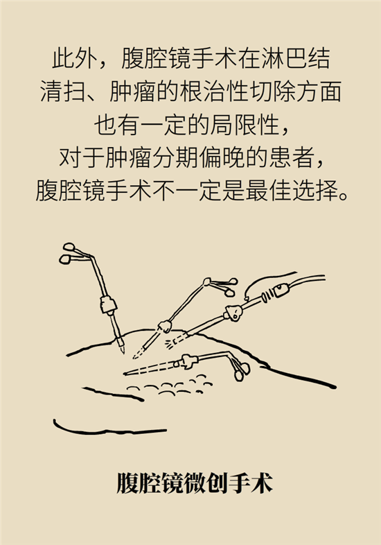胃癌手術(shù)一定要全切胃？專家：視情況而定