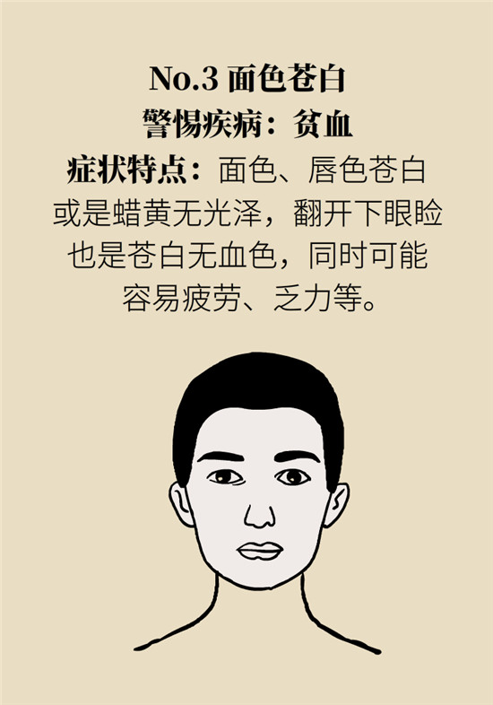 臉上的9個變化分別警示什么病？快對鏡自查