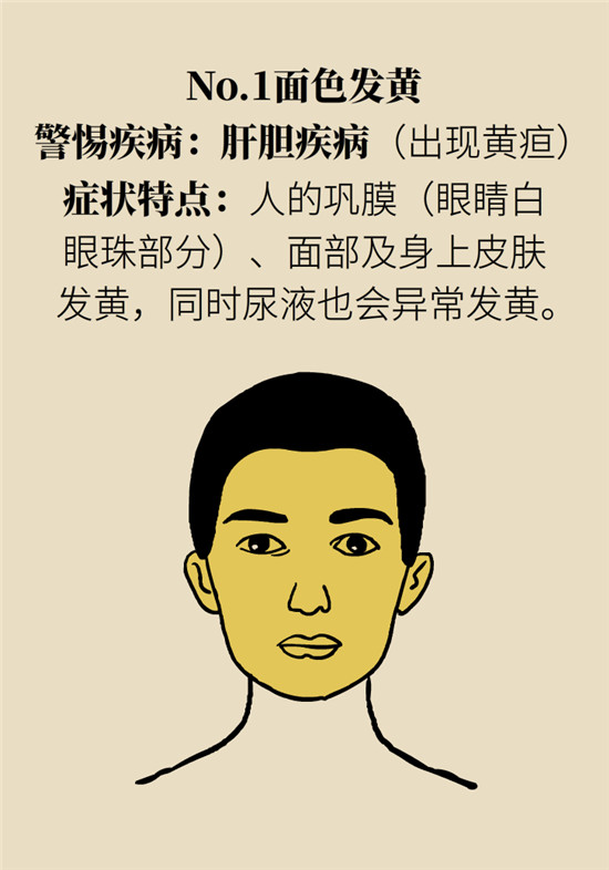 臉上的9個變化分別警示什么?。靠鞂︾R自查