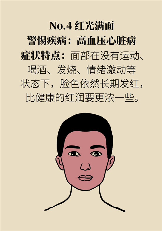 臉上的9個變化分別警示什么病？快對鏡自查