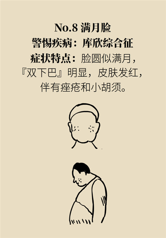 臉上的9個變化分別警示什么??？快對鏡自查