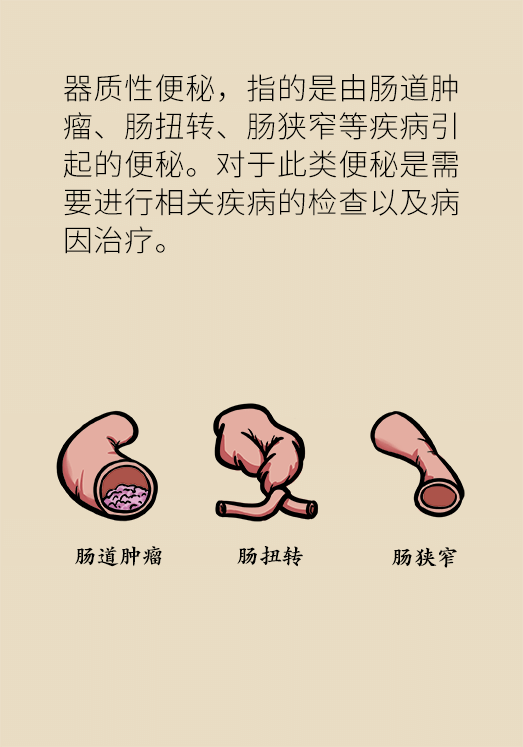 香蕉真的會緩解便秘嗎？