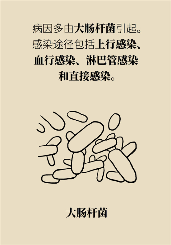經(jīng)常憋尿會(huì)得急性腎炎？