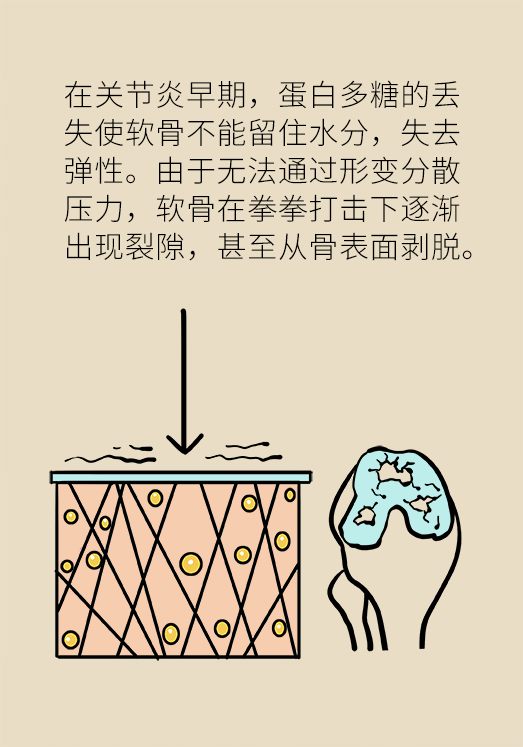 人老關(guān)節(jié)也會老嗎？