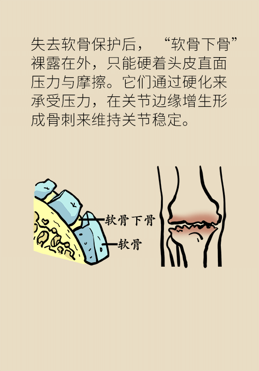 人老關(guān)節(jié)也會老嗎？