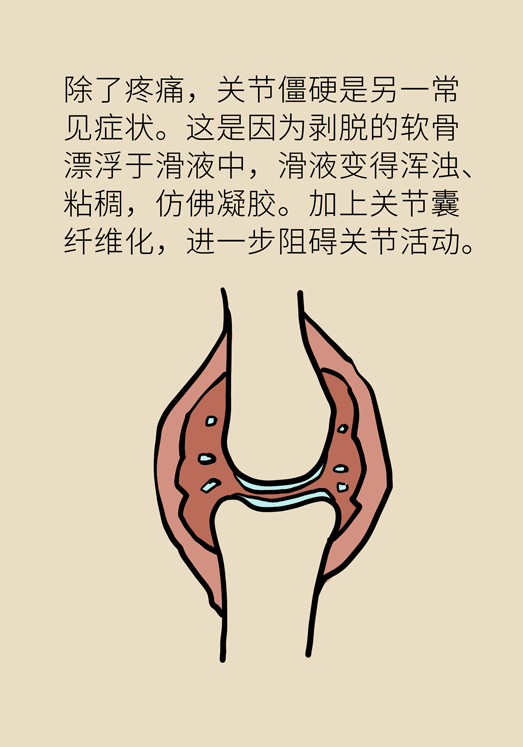人老關(guān)節(jié)也會老嗎？