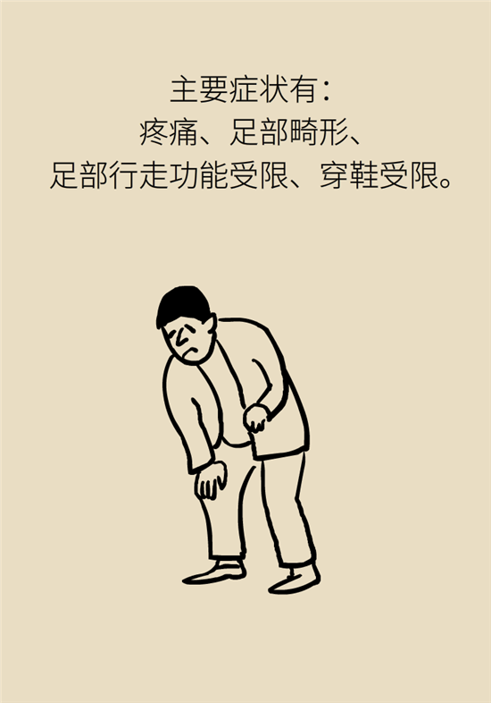 走幾百米路就疼得不行了？可能患上了平足癥