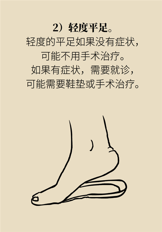 走幾百米路就疼得不行了？可能患上了平足癥