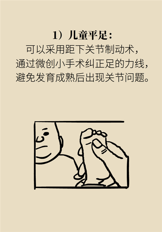 走幾百米路就疼得不行了？可能患上了平足癥