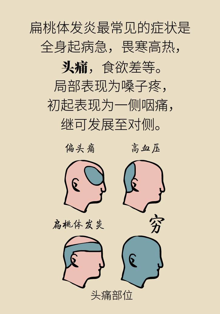 單側(cè)扁桃體腫大更兇險！謹(jǐn)防惡性腫瘤