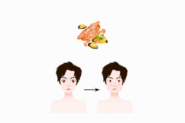 皮膚病科普動(dòng)漫制作 皮膚病科普動(dòng)漫制作
