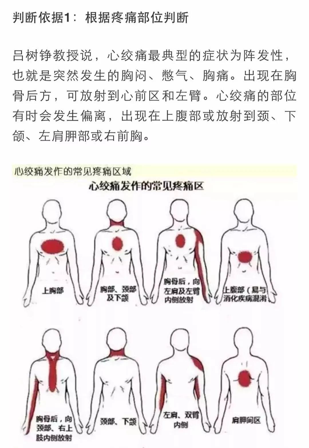 心梗有前兆！心臟發(fā)出的警報(bào)你在意了嗎？