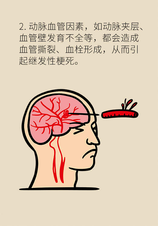 中風科普