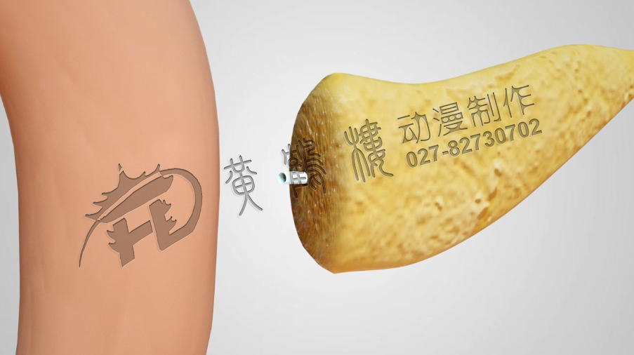 武漢醫(yī)療動(dòng)畫制作.jpg 武漢醫(yī)療動(dòng)畫制作.jpg