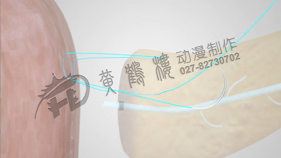 武漢醫(yī)療動(dòng)畫演示制作公司.jpg 武漢醫(yī)療動(dòng)畫演示制作公司.jpg