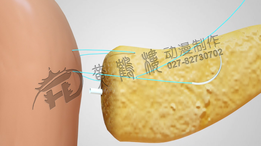 武漢醫(yī)學(xué)制作動(dòng)畫公司.jpg 武漢醫(yī)學(xué)制作動(dòng)畫公司.jpg