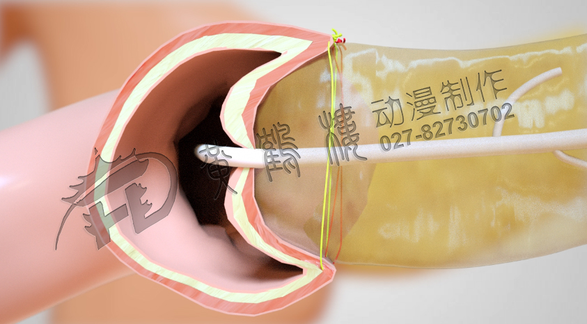 武漢制作醫(yī)療動(dòng)畫公司.jpg 武漢制作醫(yī)療動(dòng)畫公司.jpg