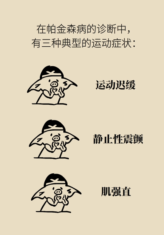 醫(yī)療動(dòng)畫(huà)帕金森病科普