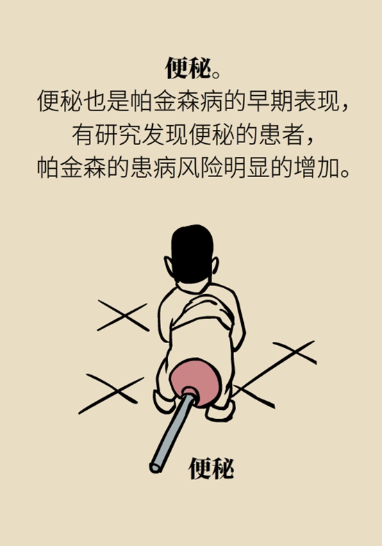 醫(yī)療動(dòng)畫(huà)帕金森病科普