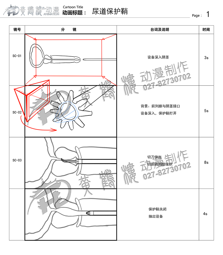 尿道保護(hù)鞘分鏡頭設(shè)計(jì) 尿道保護(hù)鞘分鏡頭設(shè)計(jì)
