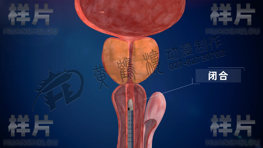 醫(yī)療器械產(chǎn)品動(dòng)畫(huà)制作.jpg 醫(yī)療器械產(chǎn)品動(dòng)畫(huà)制作.jpg