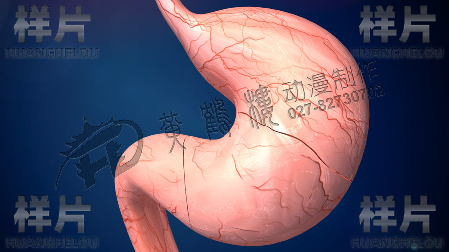 切開(kāi)胃.jpg