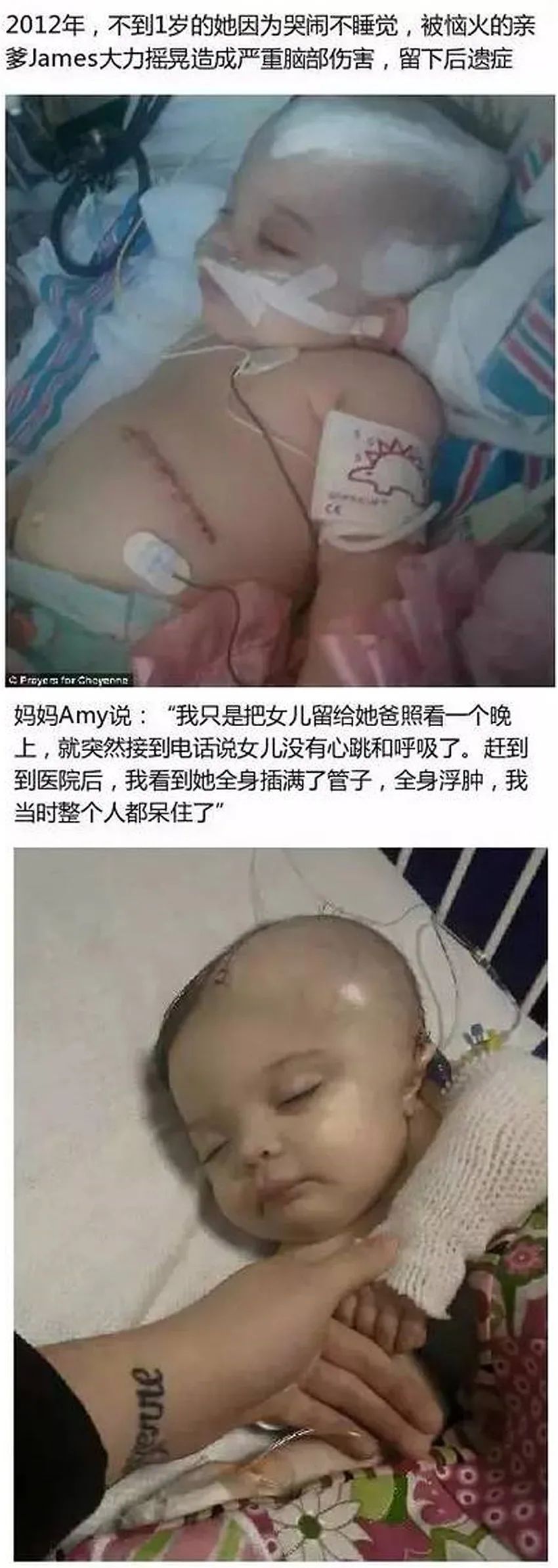 育兒醫(yī)學(xué)科普:大力搖晃會損傷寶寶的大腦致腦損傷