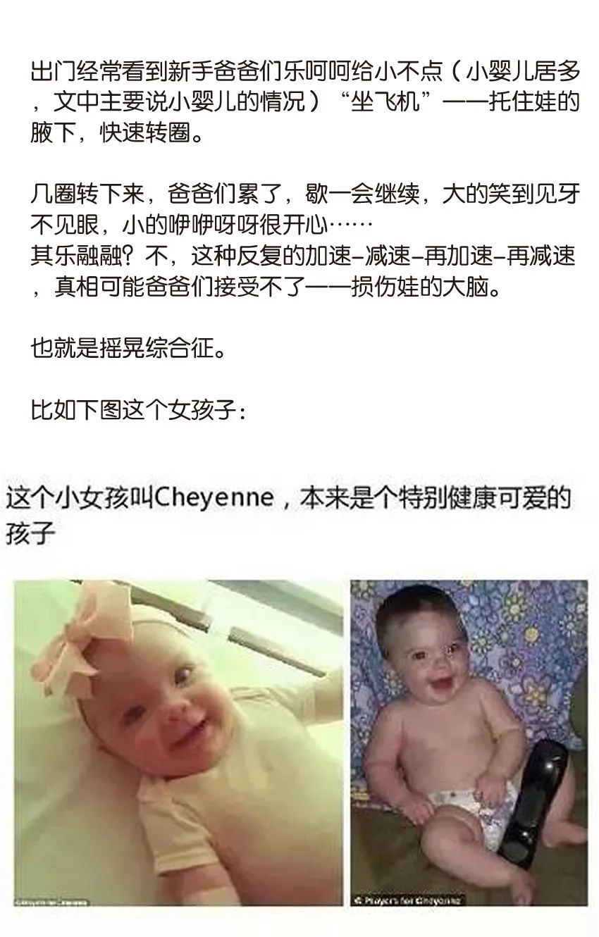 育兒醫(yī)學(xué)科普:大力搖晃會損傷寶寶的大腦致腦損傷