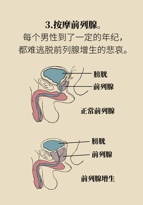 怎么做可以預(yù)防痔瘡呢？按摩前列腺、鍛煉盆底肌