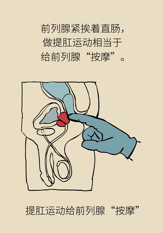 怎么做可以預(yù)防痔瘡呢？按摩前列腺、鍛煉盆底肌